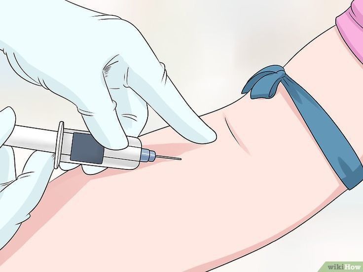 Steroid Injection